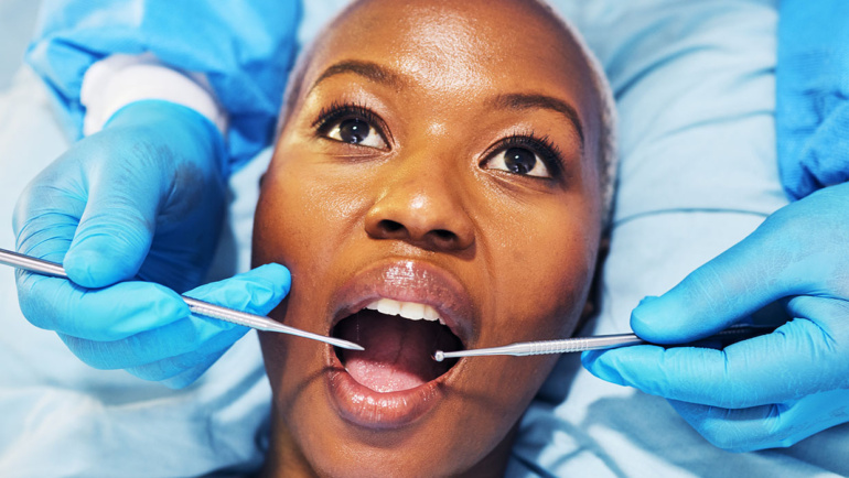 Teeth Whitening