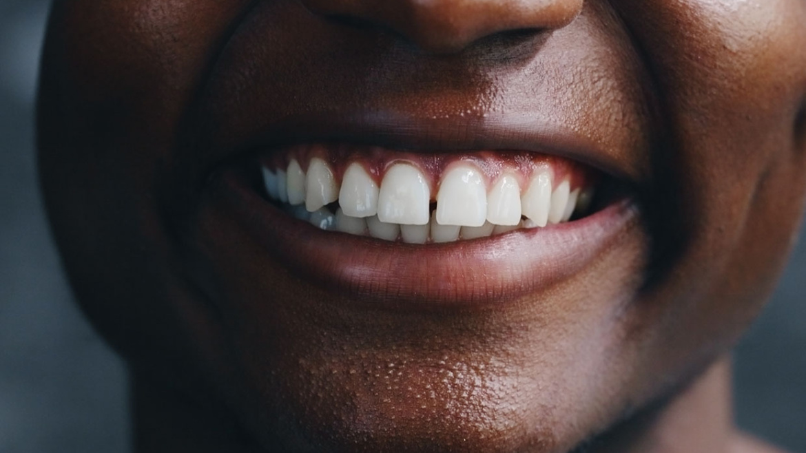 TOOTH GEMS